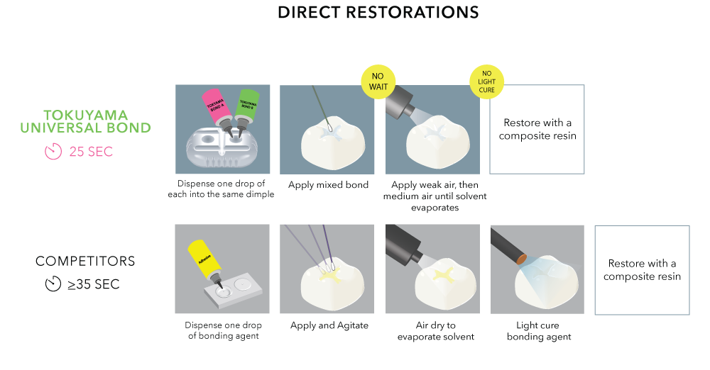3M-vs-TOK---direct-restorations