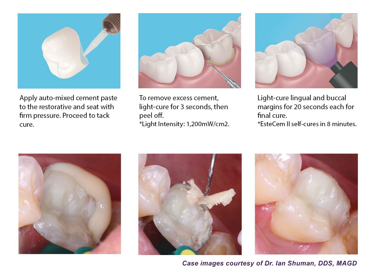 procedure_seating