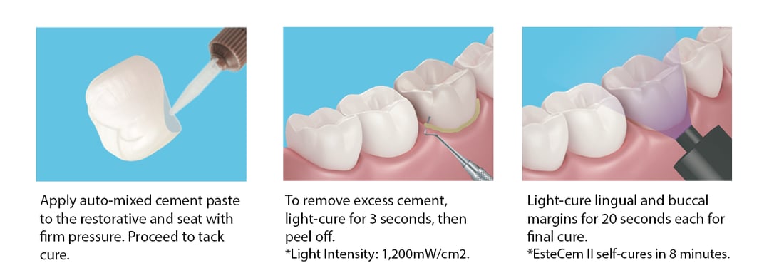 procedure_seating